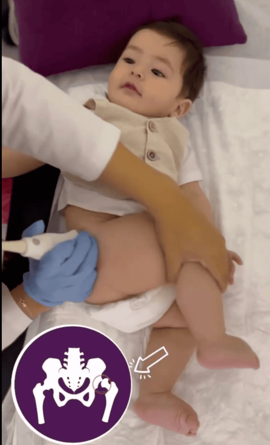 Tamiz de cadera en un bebé en Tijuana